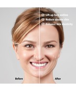 Double Chin V Line Facial Lifting Device LED Rejuvenation Face Slimming Vi - £21.23 GBP
