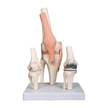 Premium Knee Joint Model Anatomy Set | Life Size Knee Joint + 2nd Stage ... - $94.11