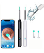 Ear Wax Removal - Wireless WiFi Visual Rechargeable Ear Cleaner, Hassle-... - $346.23 MXN