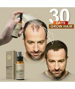 Neo Hair Lotion Growth Spray Fast Grow Hair loss Treatment Beauty Preven... - £6.31 GBP+
