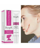 RtopR Acne Spots Anti Scar Stretch Marks Remover Skin Repair Face Cream 20g - £6.53 GBP