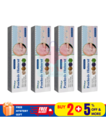 4 X Psoriasis Dermatitis Eczema Natural Cream Skin Treatment Ointment - $43.46