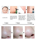 Blackhead Remover Nose Strips Serum Cream Shrink Pores Cleansing Black h... - £7.72 GBP