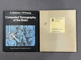 Computed Tomography of the Brain - £110.29 GBP