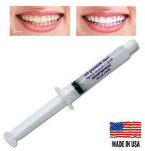 22% Whitening Gel Syringe ( 10cc = 40 apps! ) Professional Teeth Whitening Gel   - $8.95
