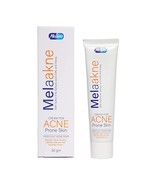 Melaakne Cream For Acne Prone Skin - $28.00