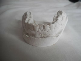 Vintage Cast Dental Teeth Mold  Tooth Castings Medical Oddity #1 - $282.72 MXN