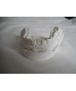 Vintage Cast Dental Teeth Mold  Tooth Castings Medical Oddity #1 - $280.11 MXN