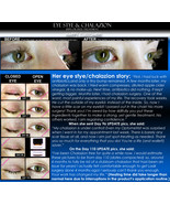 BEST Eye Stye Treatment and Chalazion Treatment 2 IN 1 Product Oil-Free  - £26.29 GBP