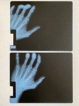 Real 2 Hand X-Rays Top View Film Sheets for Education Art 11.5x9.2in PII... - $49.95