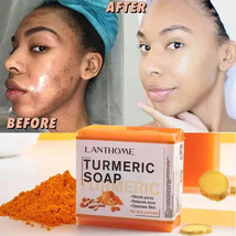 Handmade Turmeric  Ginger Soap AntiAcne Lightening  Cleansing - $20.99+
