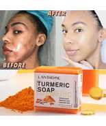 Handmade Turmeric  Ginger Soap AntiAcne Lightening  Cleansing - $392.13 MXN+