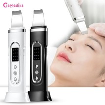 Skin Scrubber Electric Facial Cleansing Pore Deep Cleaner Acne Blackhead - £34.29 GBP