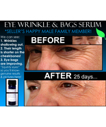BEST NATURAL EYE WRINKLE TREATMENT &amp; EYE BAGS TREATMENT 2 IN 1 PRODUCT - £28.52 GBP