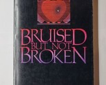 Bruised But Not Broken Stanley C. Baldwin 1985 Paperback  - $8.90