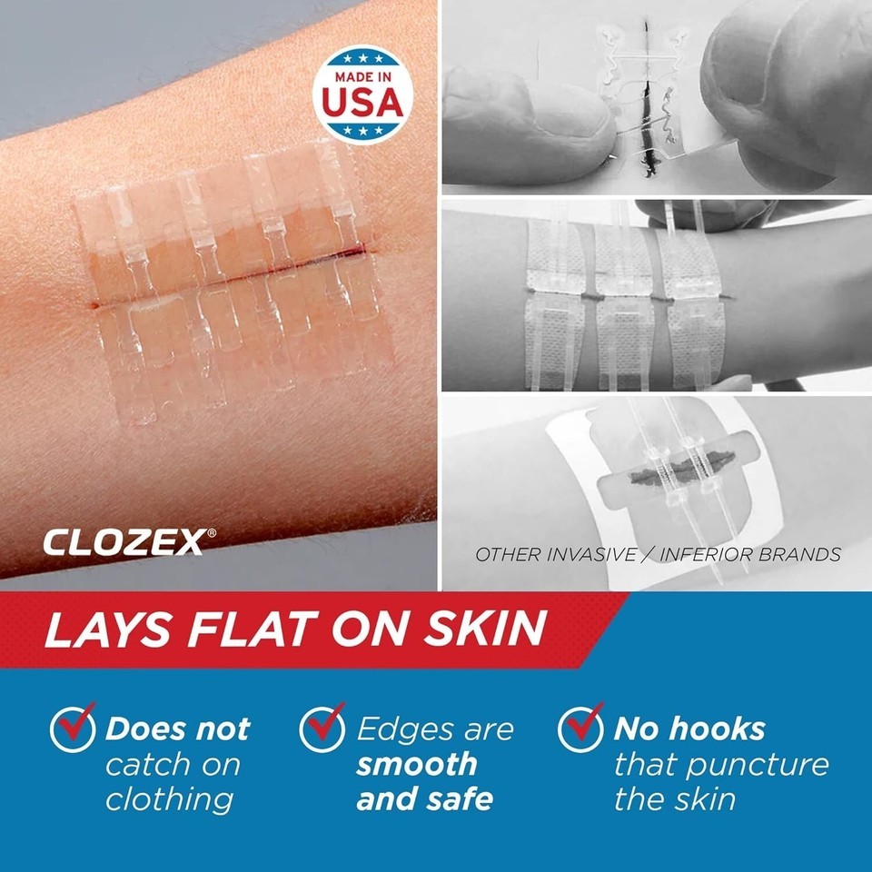 3 Pack Non-Invasive Skin Closure Device – Easy Application, Great for Kids Item image 6