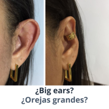 Protruding ear corrector Earclic - £41.69 GBP