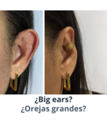 Protruding ear corrector Earclic - £41.43 GBP