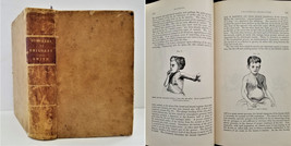 1886 Antique Diseases Infancy Childhood Illustrated Medical Children Quack Med - £178.01 GBP