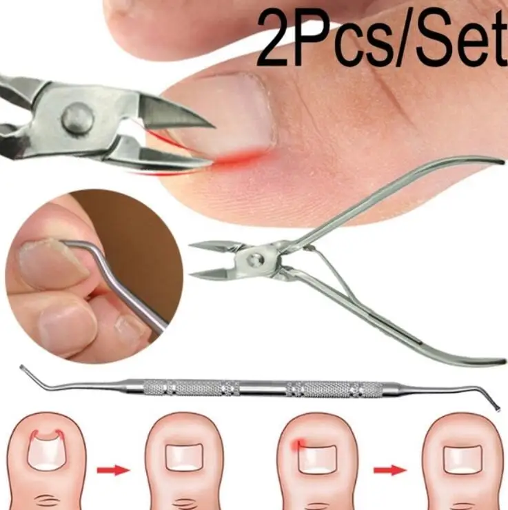 House Home Ingrown Toenails Pedicure Foot Care Tool Nail Correction Clipper Cutt - £19.81 GBP