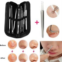 Pimple Remover Tool Kit Blackhead Extractor Comedone Acne Spot Popper 16Heads - £12.59 GBP