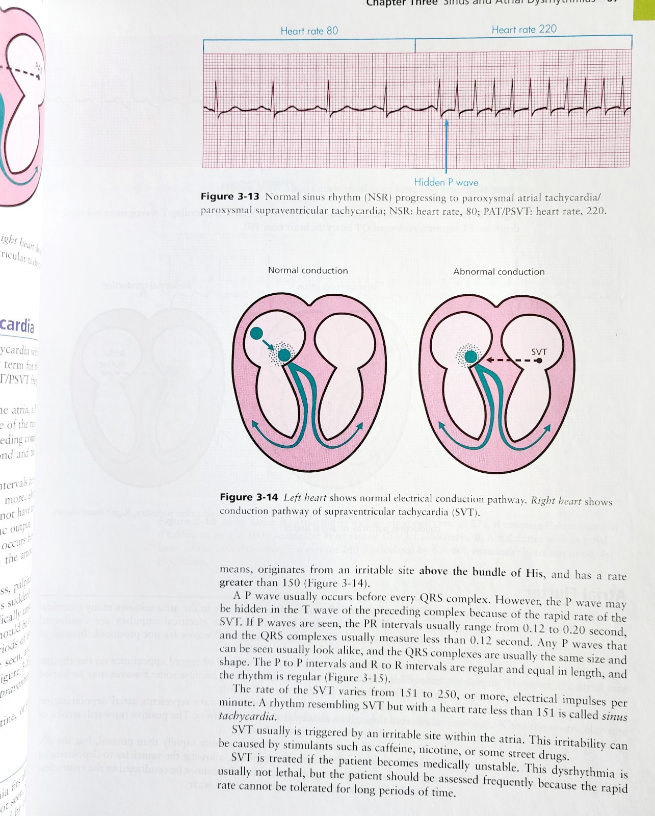 2009 Basic Cardiac Dysthymias Medical Textbook w/ Unused CD Heart PB WHBS Item image 6