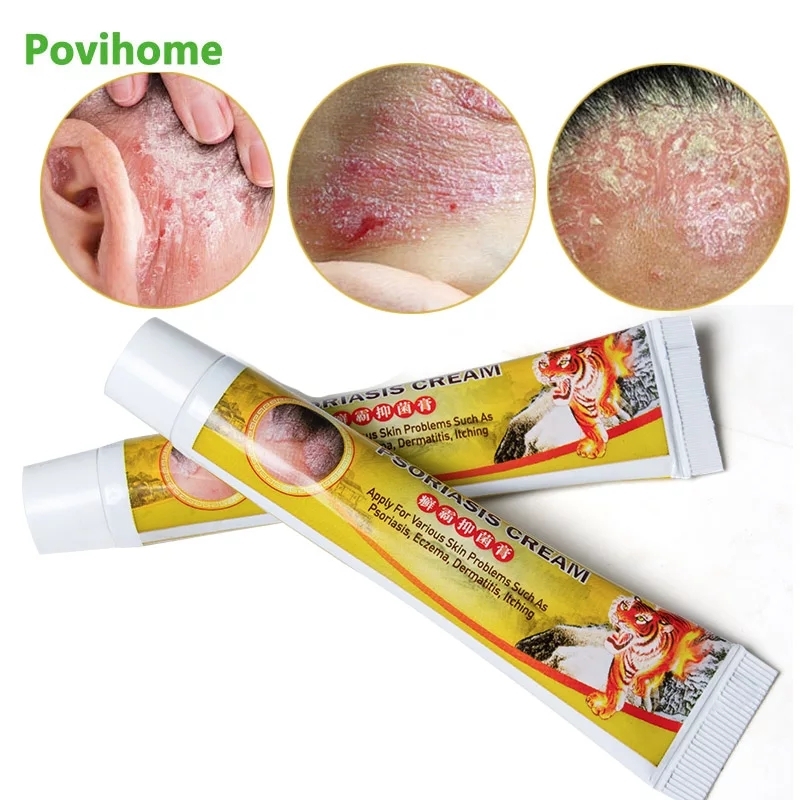2pcs Skin Psoriasis Cream Dermatitis Eczematoid Eczema Ointment Treatment Psoria