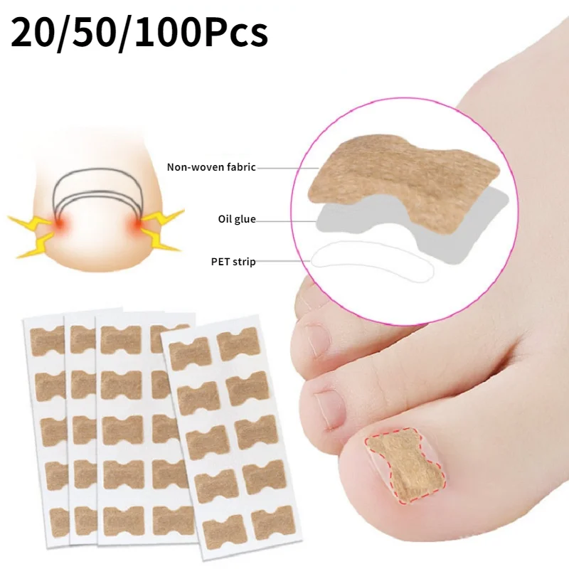 Sporting 20/50/100pcs Nail Correction Stickers Ingrown Toenail Corrector Patches - £18.54 GBP