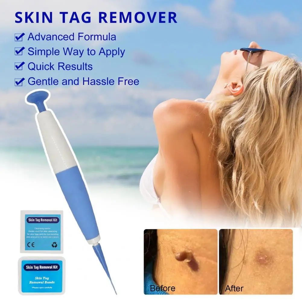 1 Set Wart Removing Pen Set Auto Skin Tag Remover Painless Mole Wart Remover Ski - £18.78 GBP