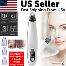 Electric Blackhead Remover Cleaner Face Diamond Pore Vacuum Suction White Heads - £14.30 GBP