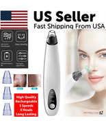 Electric Blackhead Remover Cleaner Face Diamond Pore Vacuum Suction Whit... - £14.09 GBP