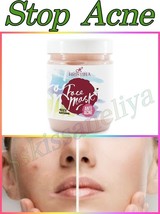 Face Mask Anti Acne Pimple Spots Treatment-Soothes Shrinks Pores 200ml. - $8.41