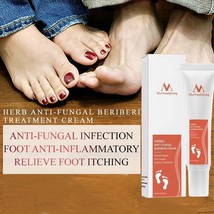 15g Foot Care Cream Skin Care Foot Peeling Dead Skin Detox Anti Fungal Infection - £19.83 GBP