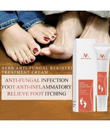 15g Foot Care Cream Skin Care Foot Peeling Dead Skin Detox Anti Fungal I... - £19.63 GBP