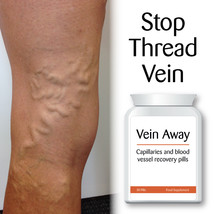 VEIN AWAY CAPILLARY &amp; BLOOD VESSEL RECOVERY PILL TABLET BROKEN VEINS SPI... - $29.99