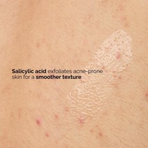 Salicylic Acid 0.5% Body Serum Exfoliating Treatment for Acne - $32.25
