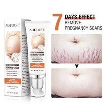 Women Cream Remove Stretch Marks Anti Wrinkle Anti Aging Maternity Skin Repair - £15.76 GBP