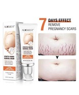 Women Cream Remove Stretch Marks Anti Wrinkle Anti Aging Maternity Skin ... - £15.44 GBP