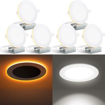 Canless Led Recessed Lighting 6 Inch 6 Pack 6Cct Ultra-Thin Recessed Downlight L - £91.89 GBP