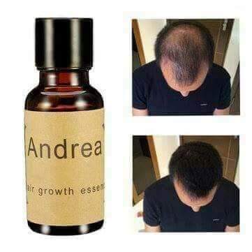 20ml Herbal Keratin Fast Hair Growth Oil, Andrea Hair Growth Serum , Alopecia Lo
