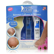 Callous Clear Foot Treatment Kit Deluxe - £5.45 GBP