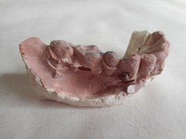 Vintage Cast Dental Teeth Mold  Tooth Castings Medical Oddity #12 - $702.36 MXN