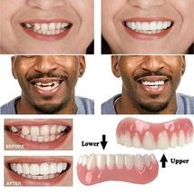 Veneers False teeth snap on instant Smile veneers Cosmetic Teeth Denture... - £12.61 GBP