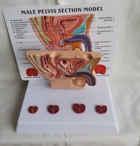 Human Male Pelvis Section Abdominal Cavity Bladder Prostate Medical Teac... - £46.51 GBP