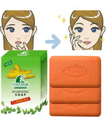 3Piece Handmade Turmeric Soap Set for Clear Radiant Skin - $618.42 MXN