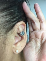Big ears corrector - $53.00