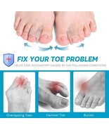 Toe Straighteners -6 Ct Correctors For Hammer, Bunion, Curled, Crooked, ... - $162.01 MXN