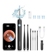 Ear Wax Removal, Ear Wax Removal Tool Camera with 1080P HD Smart Visual - $1,094.03 MXN