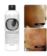 Best Acne Soap - Men Women All Natural - $13.62 CAD