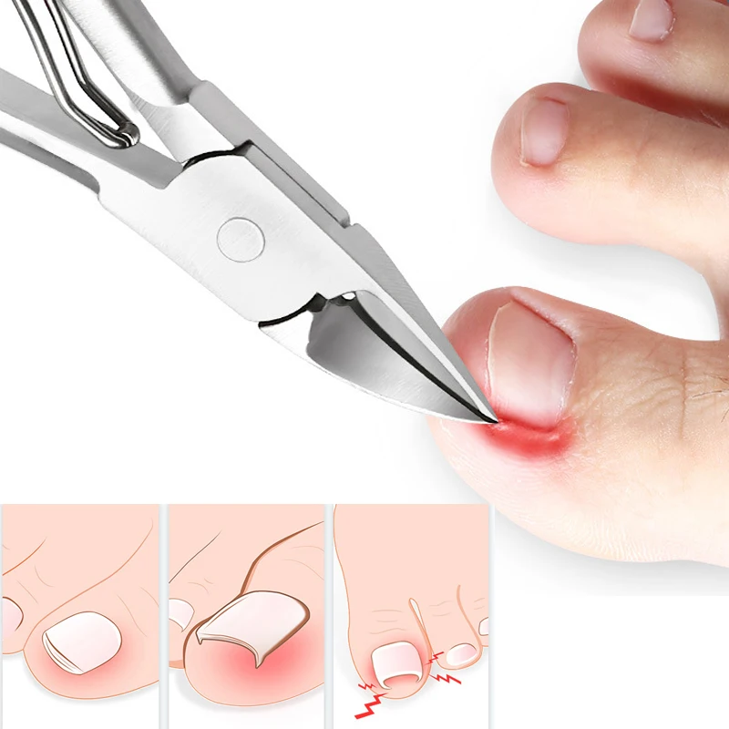 House Home New Toenail Clippers Dead Skin Remove Nail Ingrown Nipper Cuticle Sci - $25.00